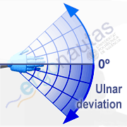 Angle measurement – Wrist ulnar deviation